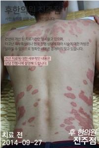 전후사진