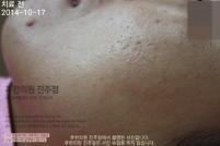 전후사진