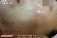 전후사진