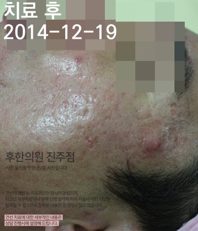 전후사진