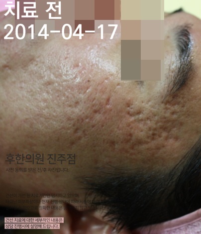 전후사진