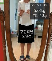 전후사진