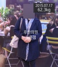 전후사진