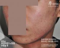 전후사진
