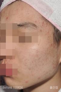전후사진