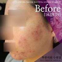 전후사진