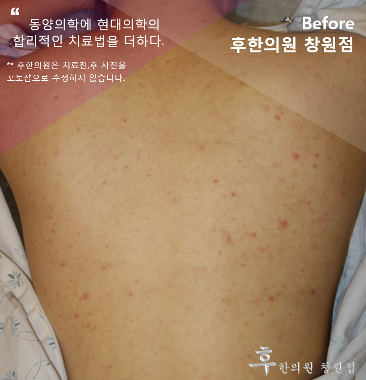 전후사진