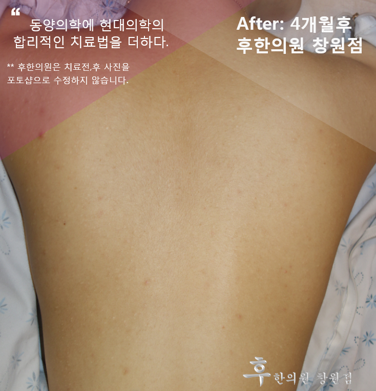 전후사진