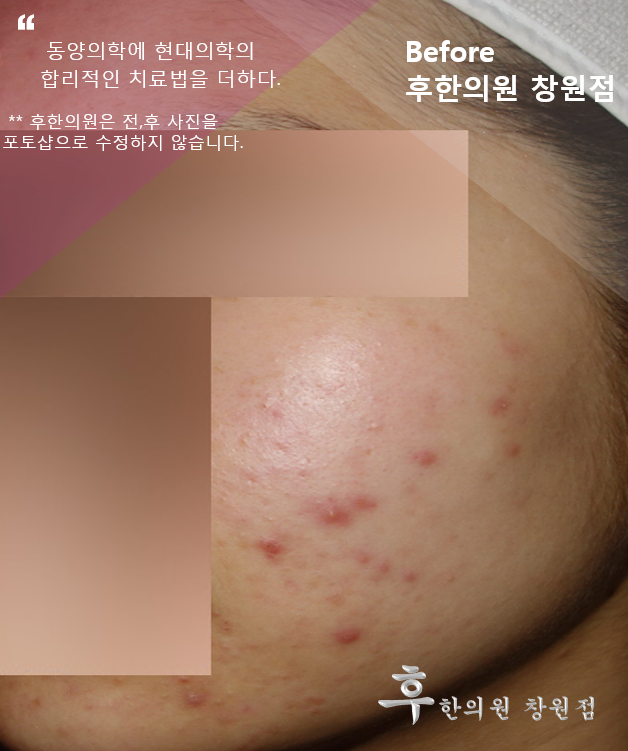 전후사진