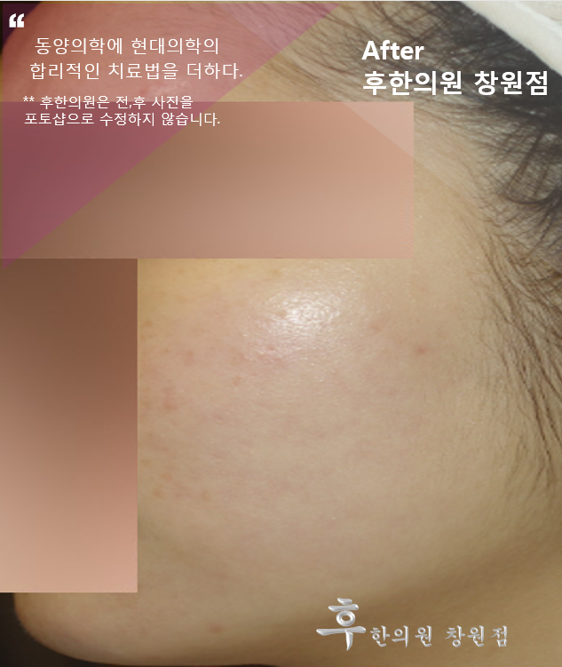 전후사진