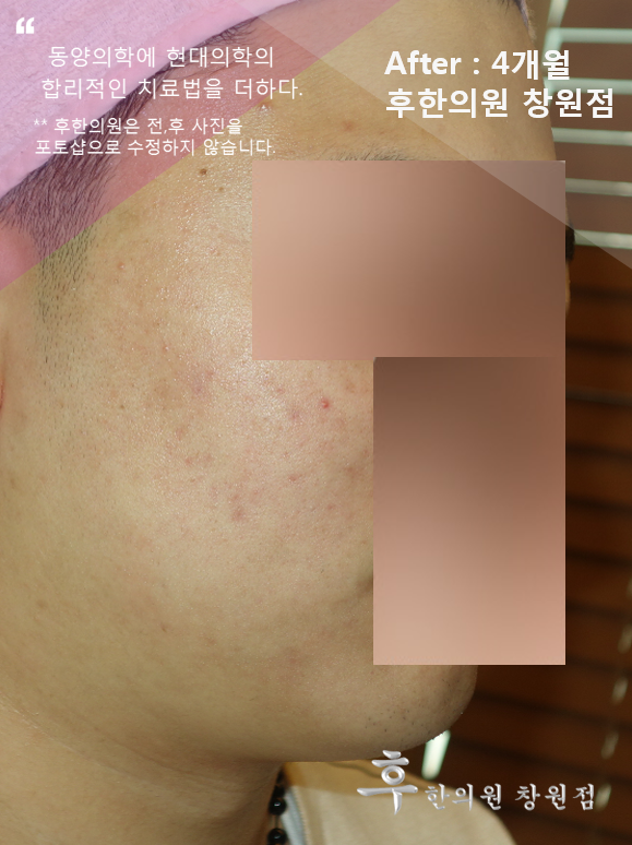 전후사진