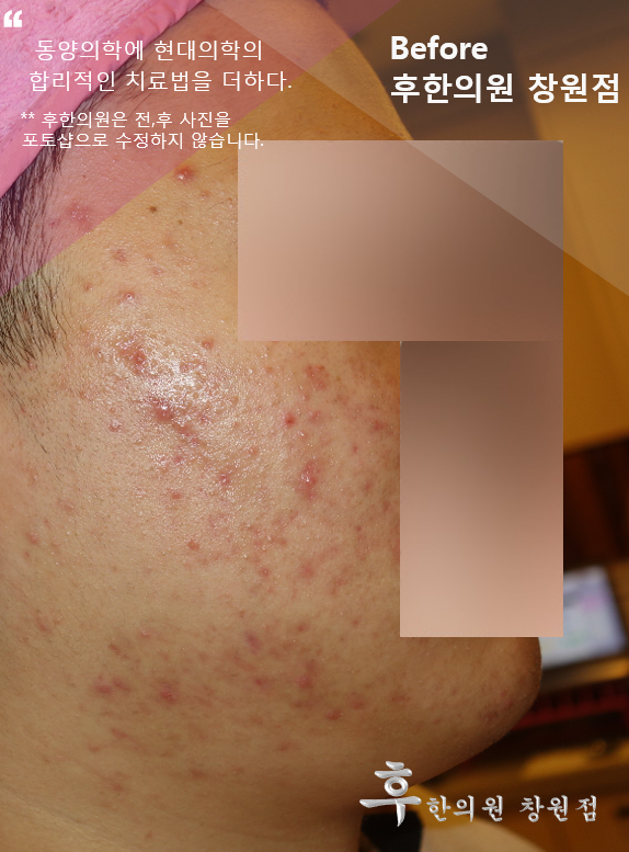 전후사진