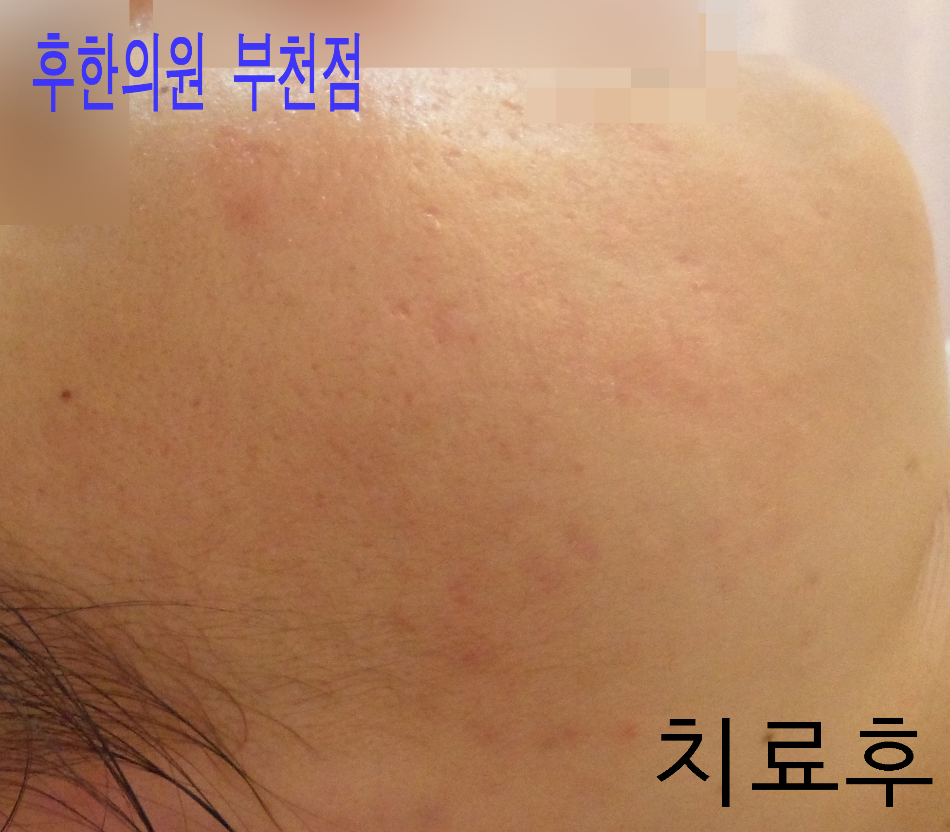 전후사진