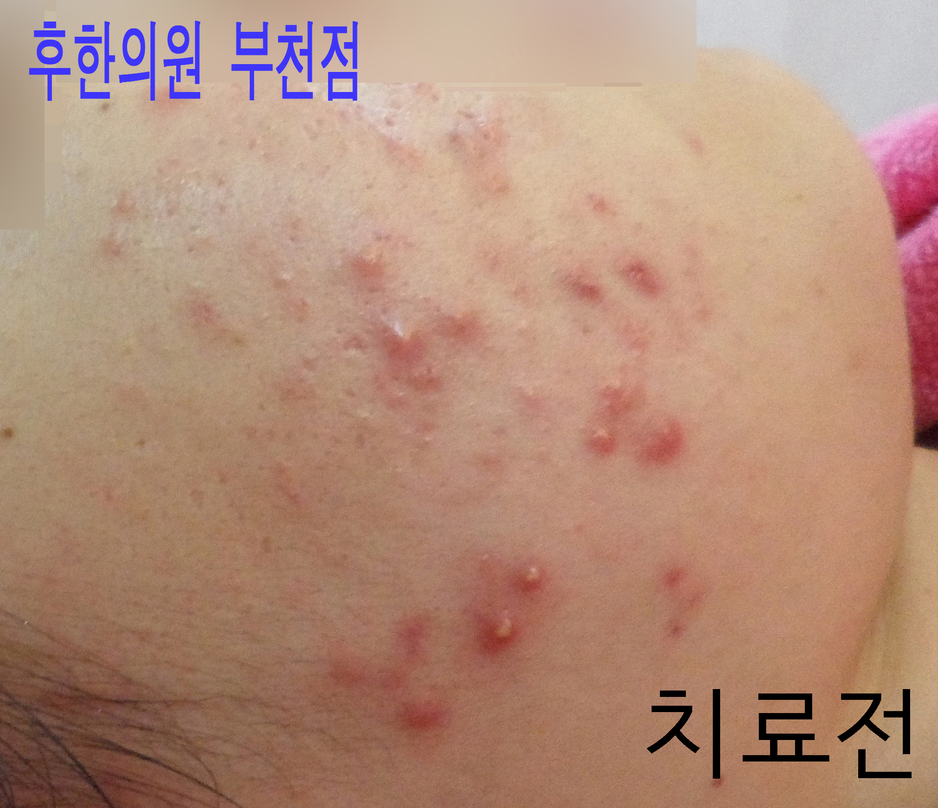 전후사진