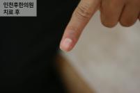 전후사진