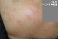 전후사진