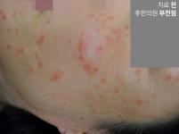 전후사진