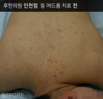 전후사진