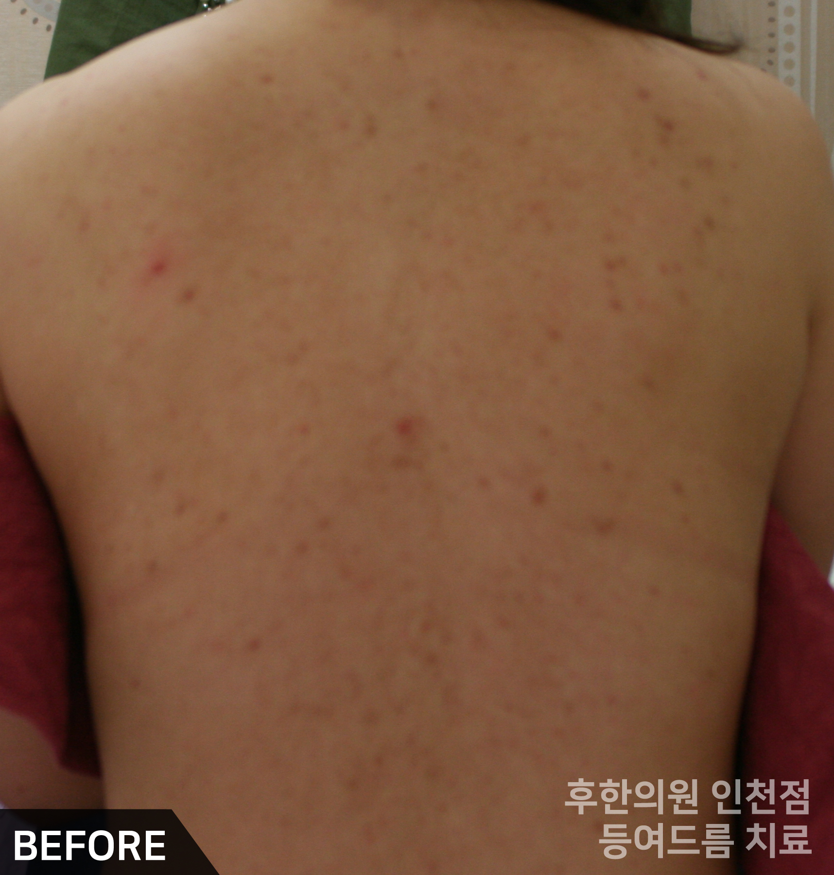 전후사진