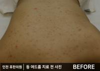 전후사진