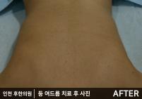 전후사진