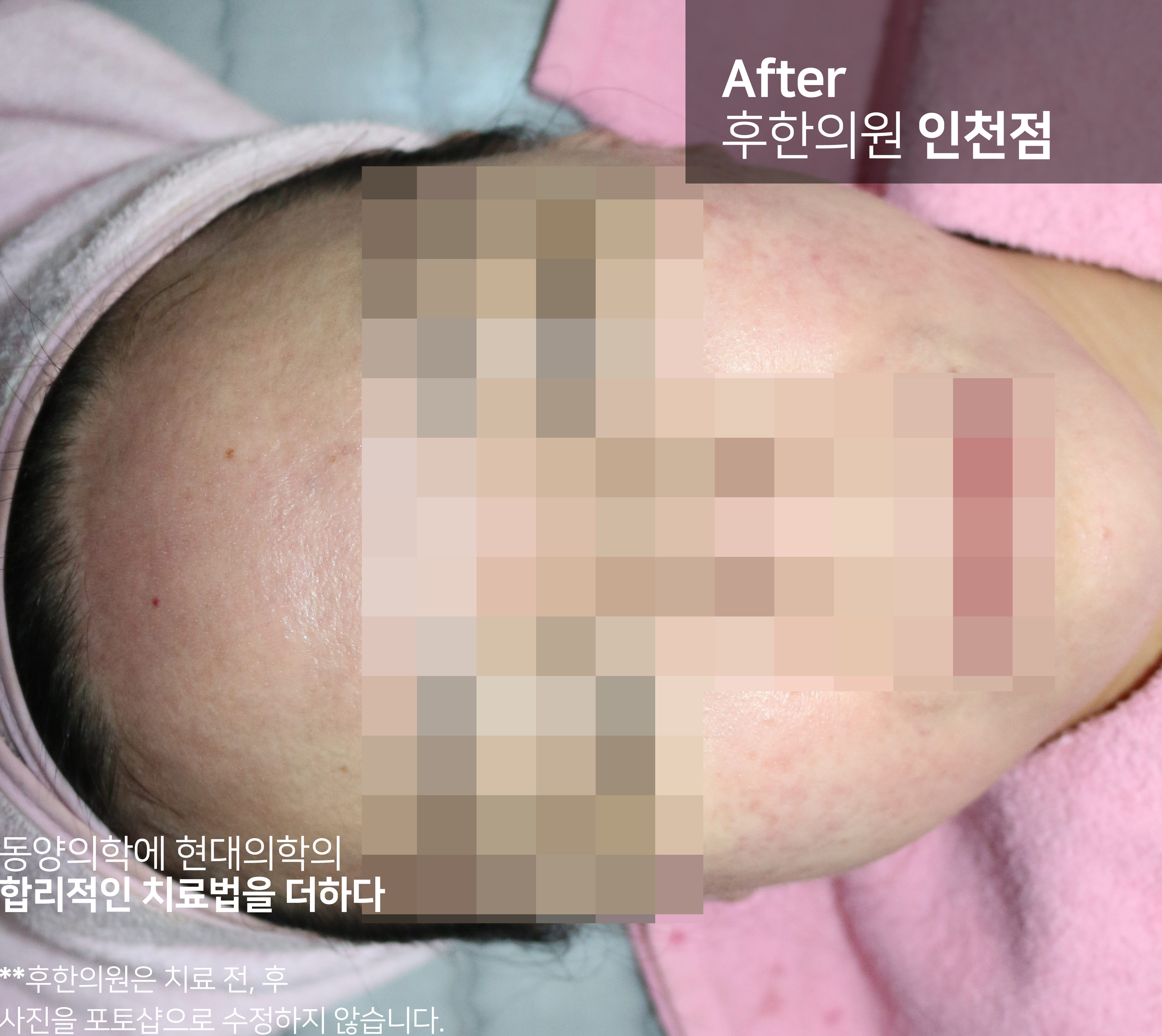 전후사진