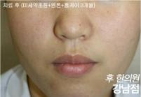 전후사진