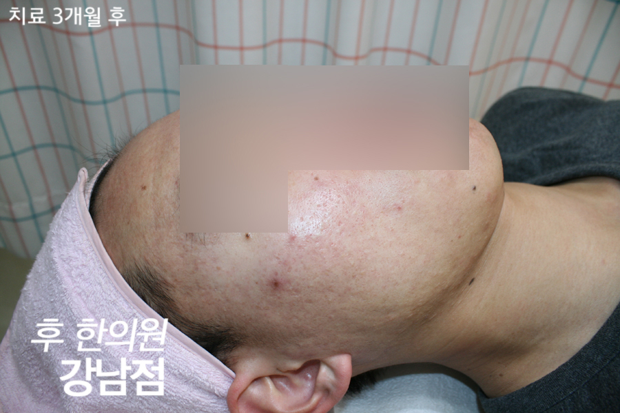 전후사진