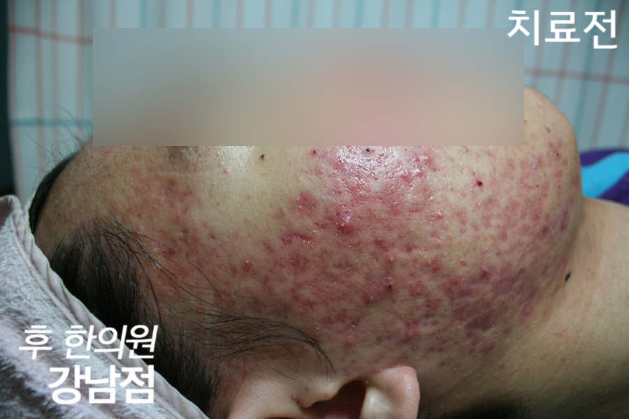 전후사진