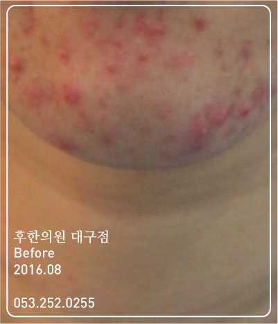 전후사진