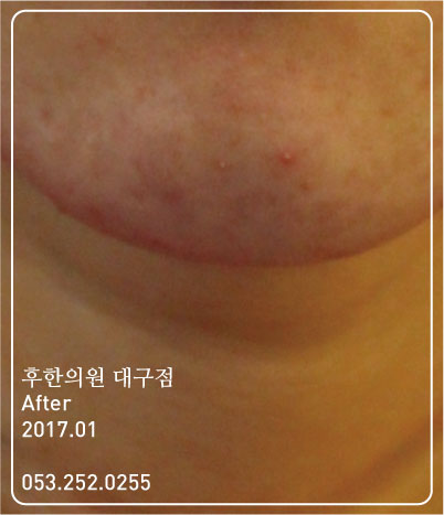 전후사진