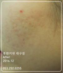 전후사진