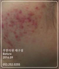 전후사진