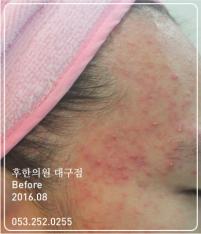 전후사진
