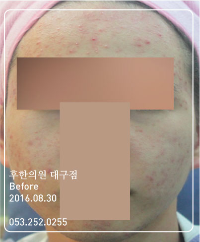 전후사진