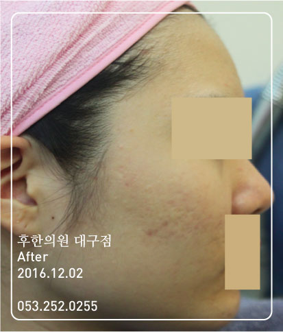전후사진
