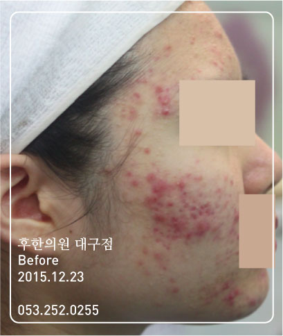 전후사진