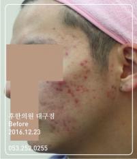 전후사진