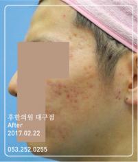 전후사진