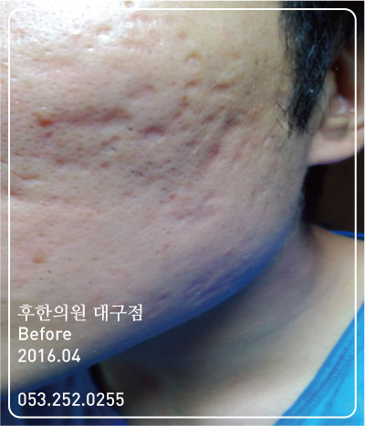 전후사진