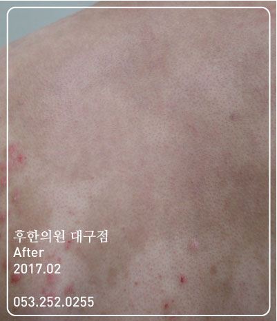 전후사진