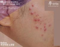전후사진