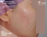 전후사진