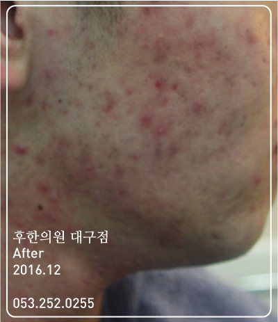 전후사진
