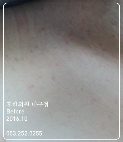 전후사진