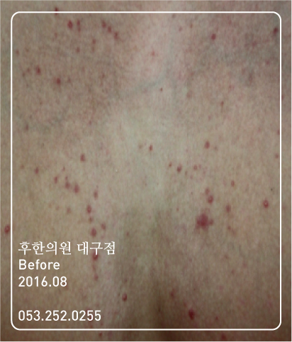 전후사진