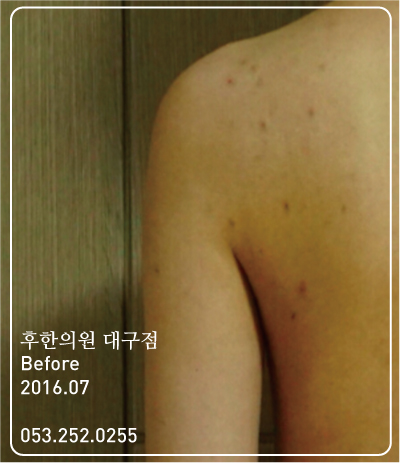 전후사진