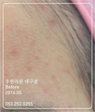 전후사진