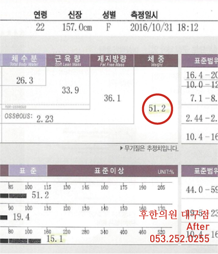 전후사진