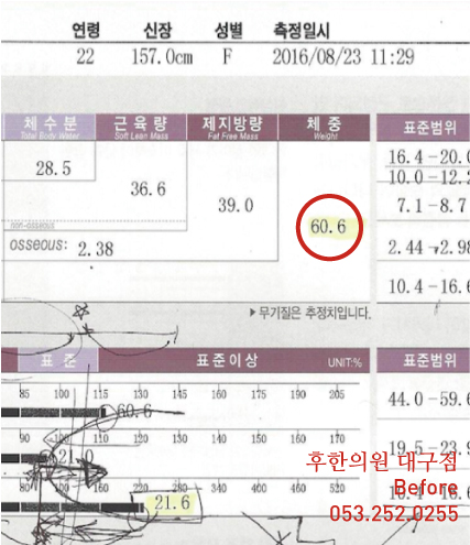 전후사진